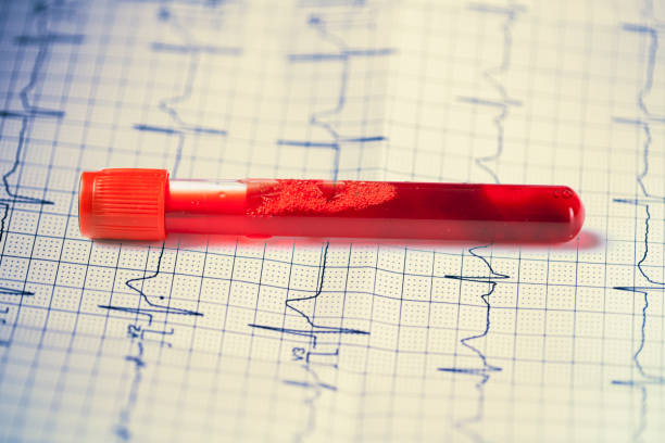 istock heart Electrocardiogram on paper with blood sample 1282107587