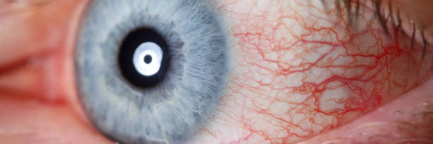 istock Irritated male blue eye full with capillar net 1282197834