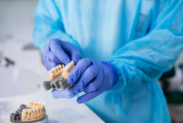 dentista organizando coronas de dientes de circonio. - teeth implant fotografías e imágenes de stock