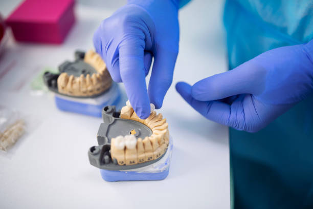 Dentist arranging zirconium teeth crowns. close up of unrecognizable dentist arranging ceramic teeth crowns. dental crown stock pictures, royalty-free photos & images