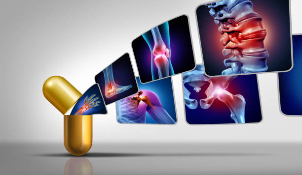 関節痛の医学 - arthritis osteoporosis pain backache ストックフォトと画像