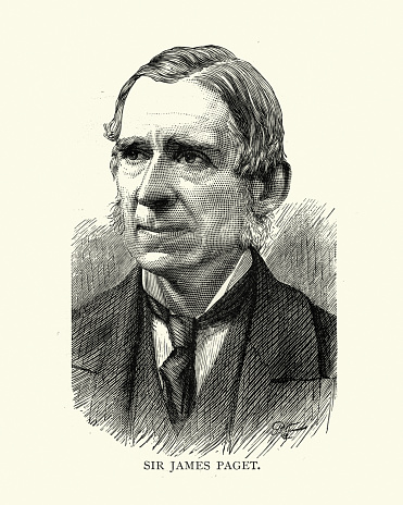 Vintage illustration of Sir James Paget, an English surgeon and pathologist who is best remembered for naming Paget's disease