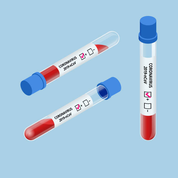 Isometric express test for COVID-19. Information Coronavirus Disease 2019 COVID-19 Isometric express test for COVID-19. Information Coronavirus Disease 2019 COVID-19. diabetes epidemiology stock illustrations