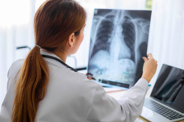 уход за людьми, инфицированными covid 19 - x ray x ray image chest human lung стоковые фото и изображения