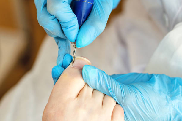 istock Hardware pedicure. Foot care 1282443460