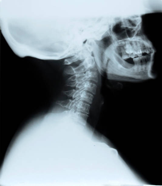 istock detail of neck and head x-ray image 1282445653