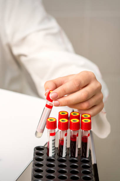 istock Nurse takes empty blood test tube 1282448852