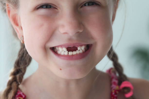 sorriso ravvicinato di una ragazza. una bellissima bambina di 6-7 anni ha perso i denti da latte. perdita di denti da latte, sostituzione dei denti permanenti. i bambini sono odontoiatria. - 6 7 years little girls child portrait foto e immagini stock