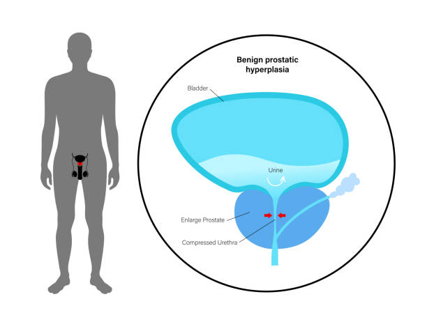 Prostate In Body The Prostate Gland Anatomical Chart Anatomy Poster