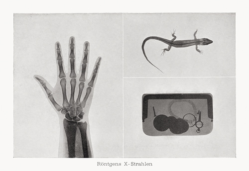 Early x-rays: human hand, lizard, and leather handbag with utensils (iscrews, coins, spiral spring, plug). Raster halftone print after photographs, published in 1899.