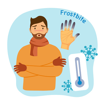 Man suffering from frostbite symptom. Guy with frozen hands in winter with cool temperatures flat design. Healthcare concept.