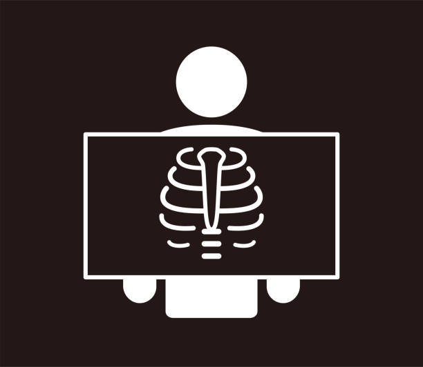 illustrazioni stock, clip art, cartoni animati e icone di tendenza di icona piatta della gabbia toracica dell'organo umano, scattando una fotografia a raggi x del paziente - radiografia