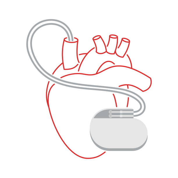 pacemaker - menschliches kardioimplantat in dünner linie - herzschrittmacher stock-grafiken, -clipart, -cartoons und -symbole