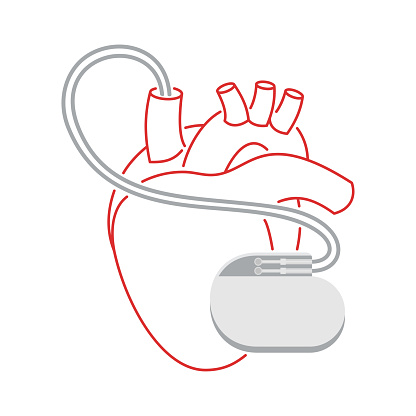 Pacemaker thin line illustration - human heart and cardio implant - vector isolated anatomic medical picture