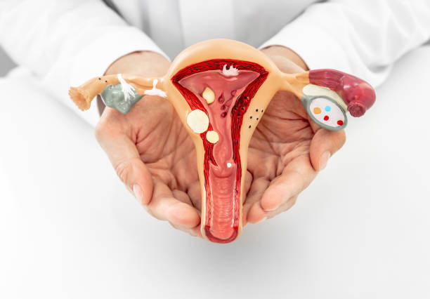 médico mostrando un modelo anatómico del útero y ovarios con patologías, primer plano. enfermedades y tratamientos ginecológicos - ovary fotografías e imágenes de stock