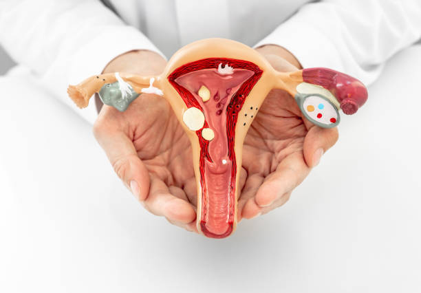 lekarz pokazujący anatomiczny model macicy i jajników z patologiami, zbliżenie. choroby ginekologiczne i zabiegi - ovary zdjęcia i obrazy z banku zdjęć