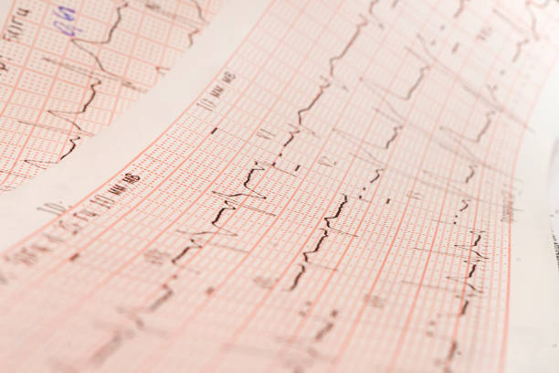 Close up of ECG, electrocardiogram. work of a healthy heart on paper. Close up of ECG, electrocardiogram. The work of a healthy heart on paper. electrocardiography photos stock pictures, royalty-free photos & images