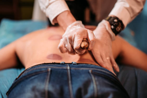 paziente maschio cinese asiatico che riceve un trattamento di terapia raschiante presso il negozio di medicina cinese - massaging relaxation indoors traditional culture foto e immagini stock