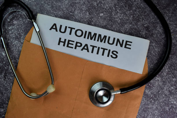 istock Autoimmune Hepatitis text with document brown envelope and stethoscope isolated on office desk. 1283343747