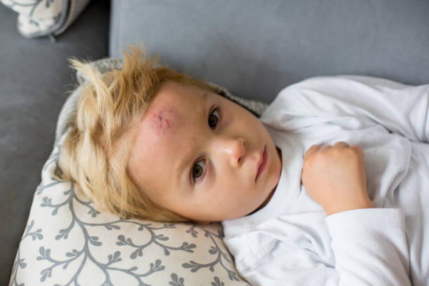 Toddler boy, lying on the couch with big bump on the forehead after falling from a swing Toddler boy, lying on the couch at home with big bump on the forehead after falling from a swing toddler hitting stock pictures, royalty-free photos & images