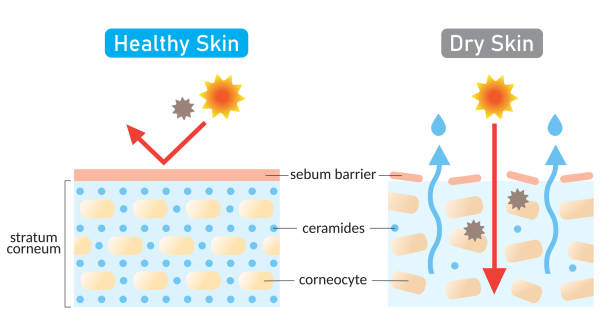 dry and healthy skin layer. stratum corneum and ceramides. illustration. beauty and skin care concept healthy skin contain ceramides that produce moist appearance. skin care illustration isolated on white background dry skin stock illustrations