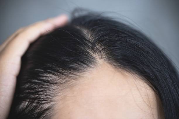 Young woman shows her gray hair roots stock photo