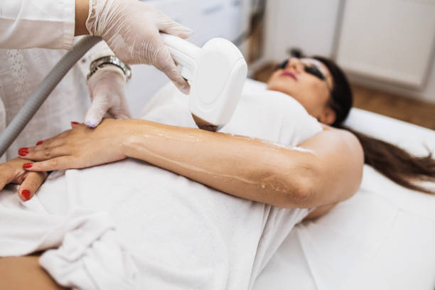 istock Woman receiving epilation treatment 1283706194