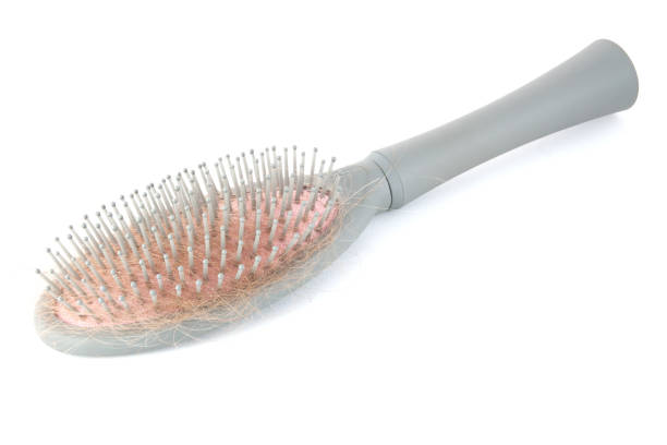 istock hairbrush with hair fall on white background 1283820002
