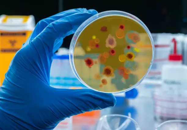 Scientist examines malaria virus on petri dish in laboratory, conceptual image