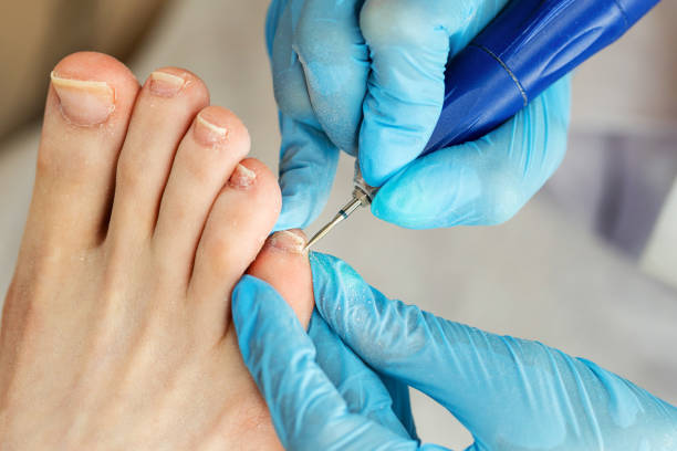 istock Hardware pedicure. Foot care 1283875133