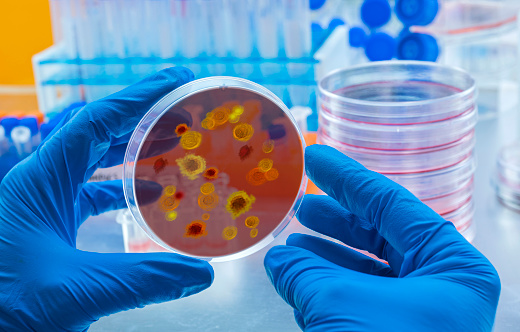 Científico examina el virus del dengue en el plato petri en laboratorio, imagen conceptual photo