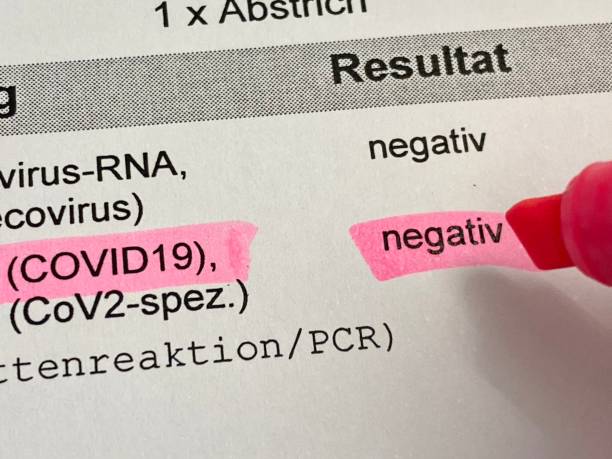 resultado negativo do teste de covid - 3000 - fotografias e filmes do acervo