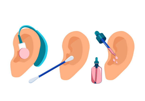 Human ears with aerophone,cotton swab and pipette.Hearing protection.Deafness prevention and otolaryngology.Personal hygiene routine and care.Removing cerumen,otitis treatment with serum medical drops Save your ear ear canal stock illustrations