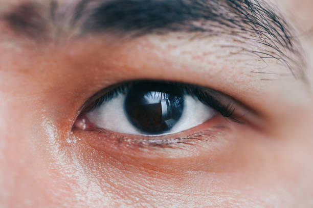 istock asian man with black eye 1284166089