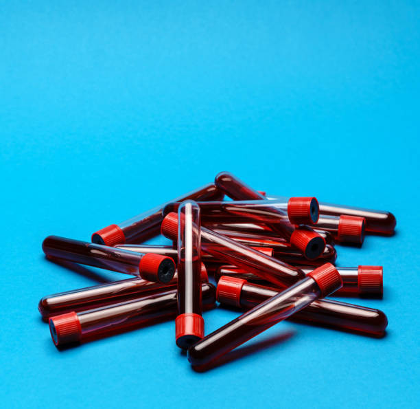 istock top view of medicine test tubes with blood samples over blue background 1284376858
