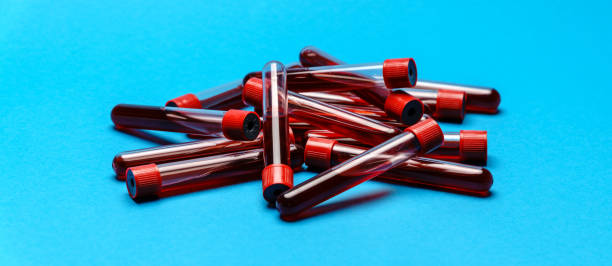 istock top view of medicine test tubes with blood samples over blue background 1284376864