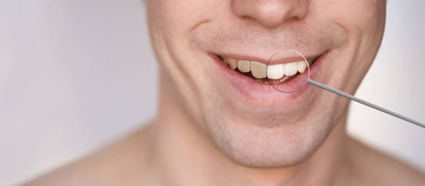 istock Men smile. Whitening oral care concept. 1284551050