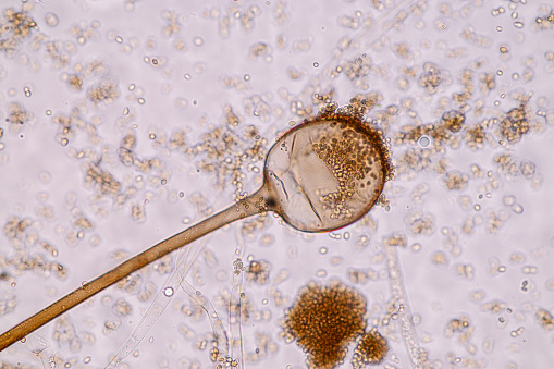 Characteristics of Rhizopus is a genus of common saprophytic fungi  on Slide under the microscope for education.