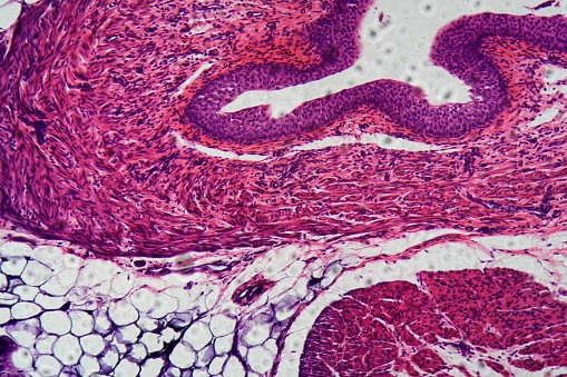 Human Transitional Epithelium Under The Microscope Stock Photo ...