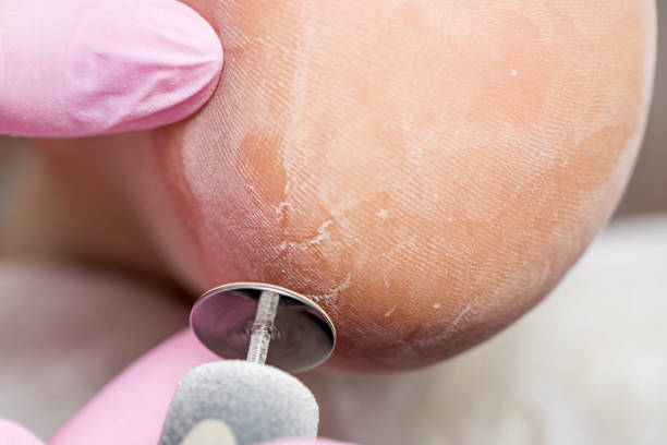 istock Male hardware pedicure in the salon. 1284752298
