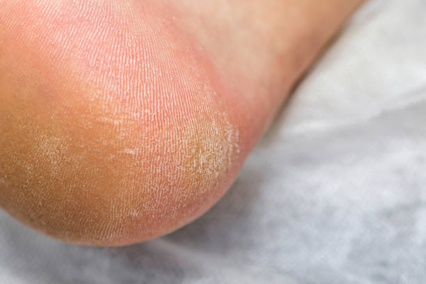 istock Male hardware pedicure in the salon. 1284754106