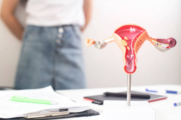 A model of the female reproductive system in the background is a girl in a doctor s office with irregular periods. The concept of problems for women with a period of menstruation, oligomenorrhea A model of the female reproductive system in the background is a girl in a doctor s office with irregular periods. The concept of problems for women with a period of menstruation, hypomenorrhea polycystic ovary syndrome photos stock pictures, royalty-free photos & images