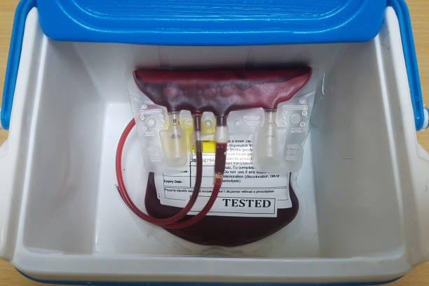 una unidad de sangre guardada en una caja antes del procedimiento de transfusión de sangre. - blood blood donation blood cell drop fotografías e imágenes de stock