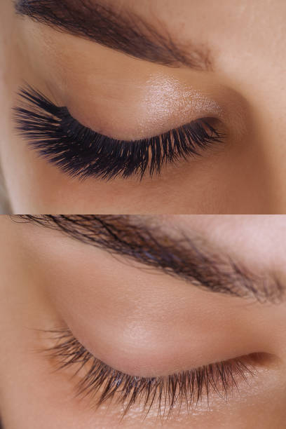istock Eyelash Extension. Comparison of female eyes before and after 1284980519