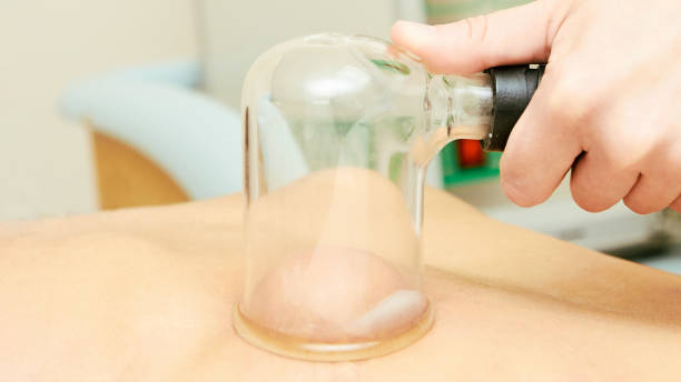 istock Medical procedure. Vacuum massage. Losing weight 1285073024