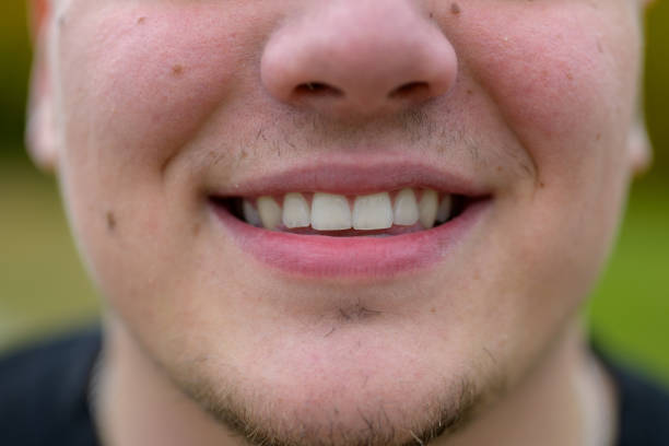 istock Close up on the teeth of a smiling young man 1285097175