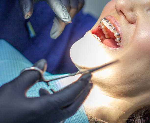istock A woman at a dentist's appointment to replace arches with braces. 1285128988