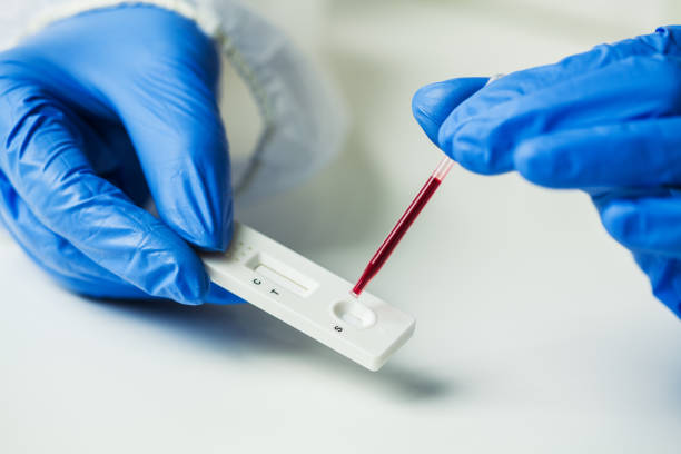 Coronavirus serological test Scientist or doctor placing blood sample on Rapid Diagnostic Rest RDT cassette,medical technician performing quick fast blood PRP testing identifying antibodies for Coronavirus SARS-CoV-2 COVID-19 antibody test stock pictures, royalty-free photos & images