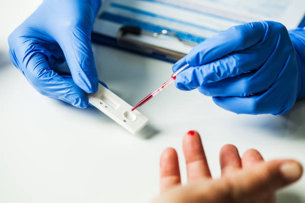 Coronavirus serological test Coronavirus COVID-19 quick Rapid Diagnostic Test, medical worker place collected patient finger prick blood sample specimen on cassette, fast point of care serological diagnostic testing procedure antibody test photos stock pictures, royalty-free photos & images