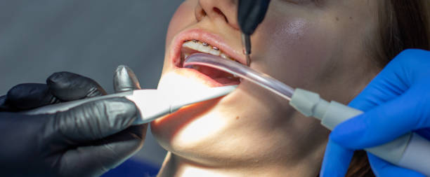 istock A woman at a dentist's appointment to replace arches with braces. 1285199432